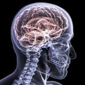 Worcester Traumatic Brain Injury Lawyers